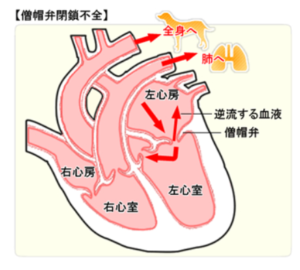 病気の心臓